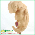 ANATOMY38(12476) Medical Anatomical Human Four-week Large Embryo Amplification Model 12476